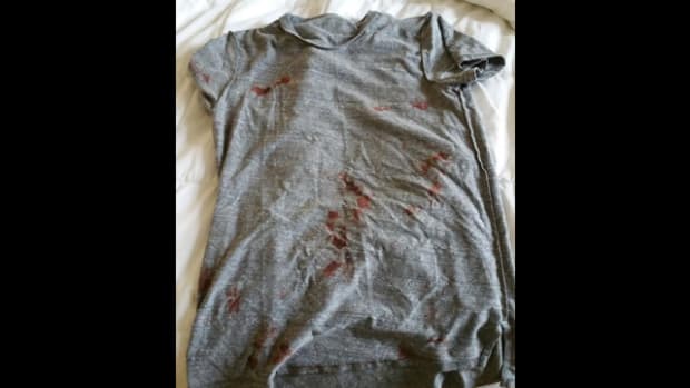 Will Brooks' blood t-shirt after the alleged fight