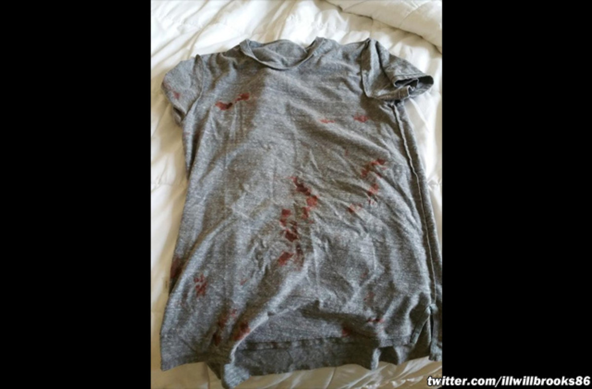 Will Brooks' blood t-shirt after the alleged fight