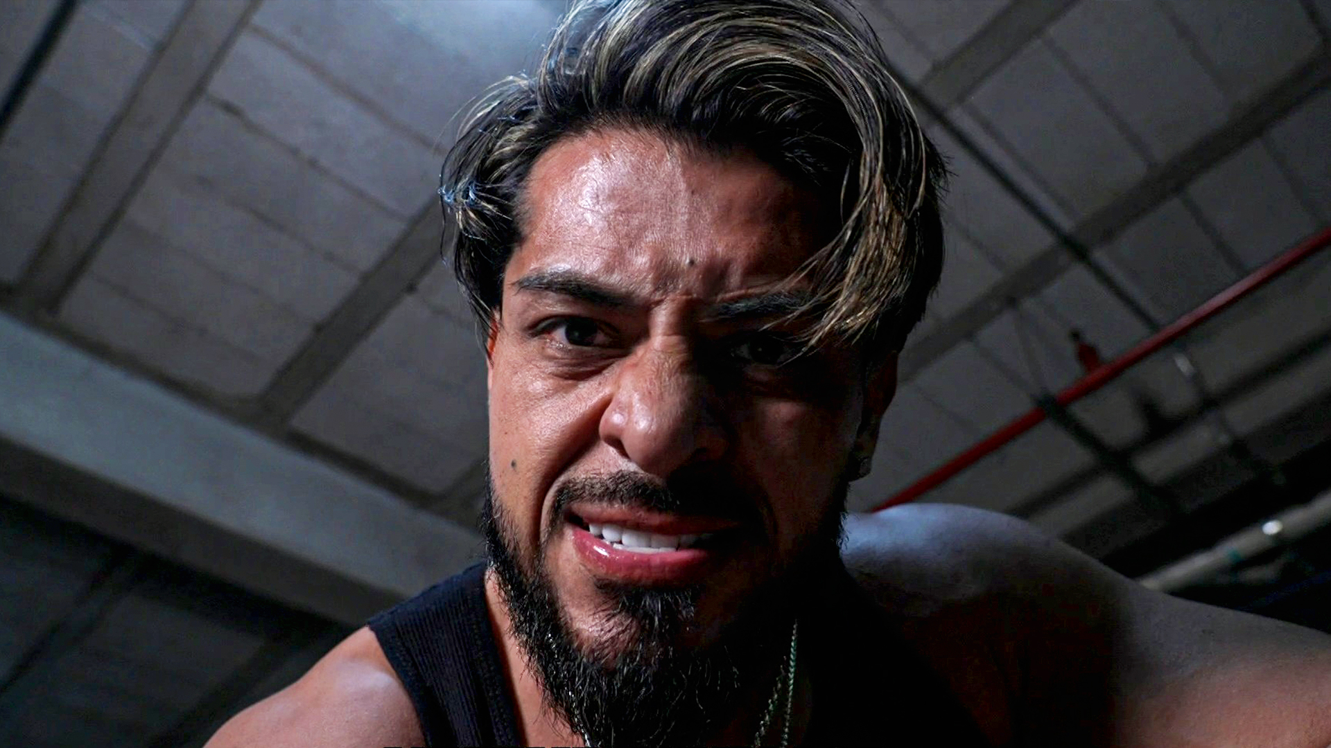 Santos Escobar to undergo surgery for tricep injury